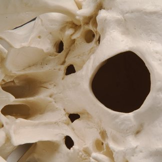 Crâne classique