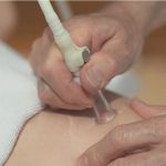 Afbeeldingen van Vacuodermie TV12