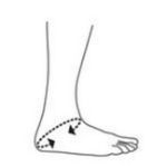 Afbeeldingen van Enkel brace