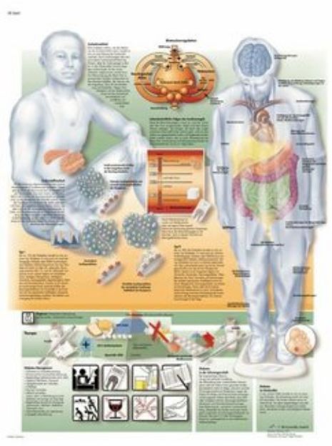 Afbeeldingen van Diabetes