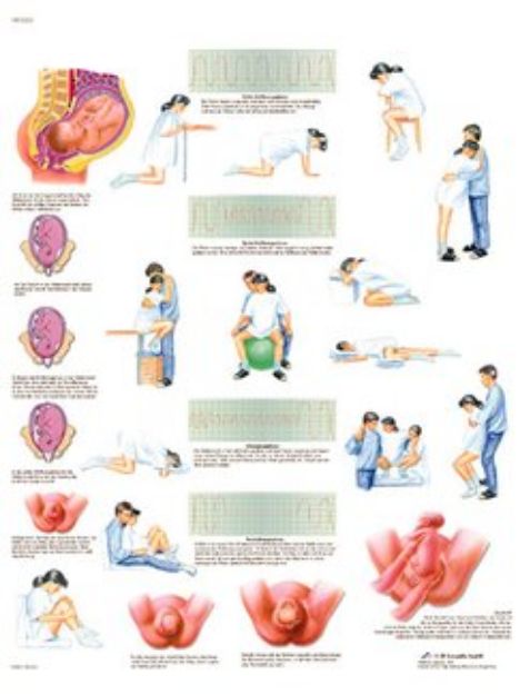 Afbeeldingen van Nieren